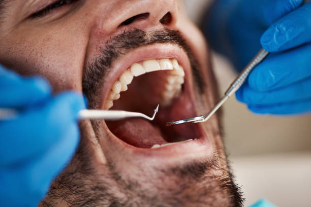 Best Emergency Dental Care for Broken or Chipped Teeth in Calera, OK