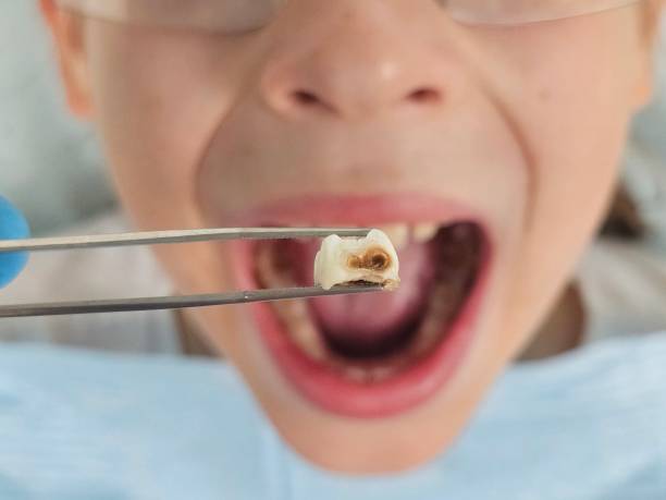 Best After-Hours Dental Trauma Care in Calera, OK